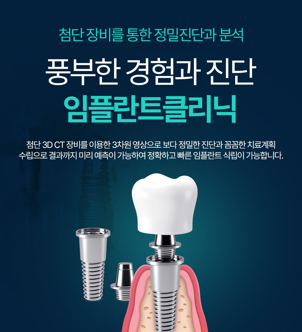 풍부한 경험과 진단 임플란트클리닉